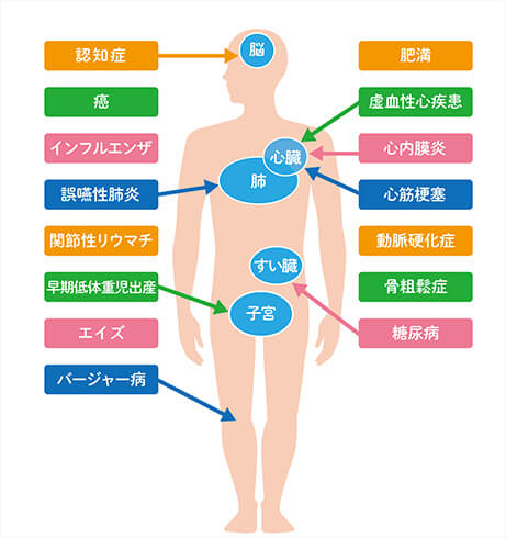 歯周病が全身に与える影響