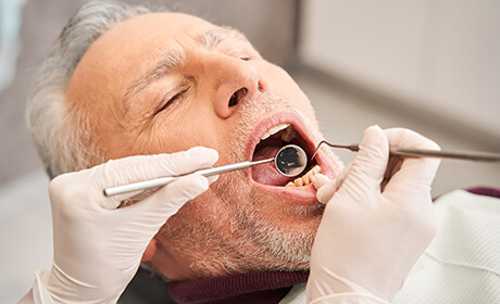 むし歯・歯周病の治療